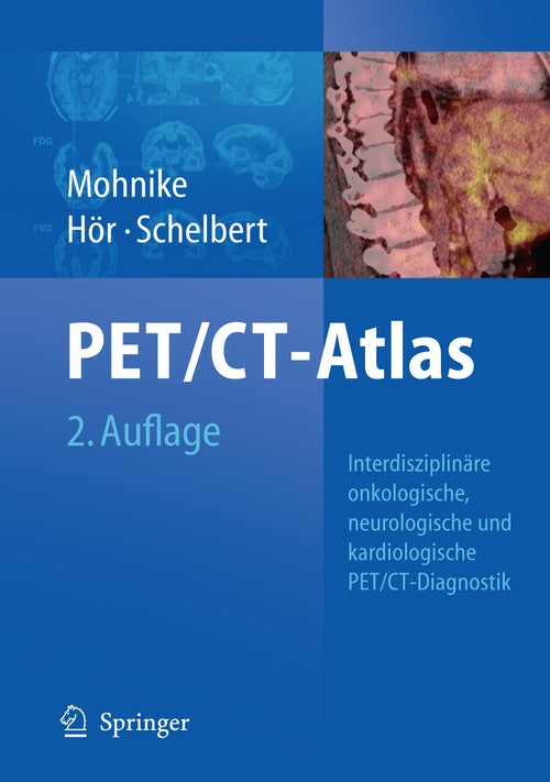 Oncologic and Cardiologic PET/CT-Diagnosis by Wolfgang Mohnike | ISBN-13 9783540740902