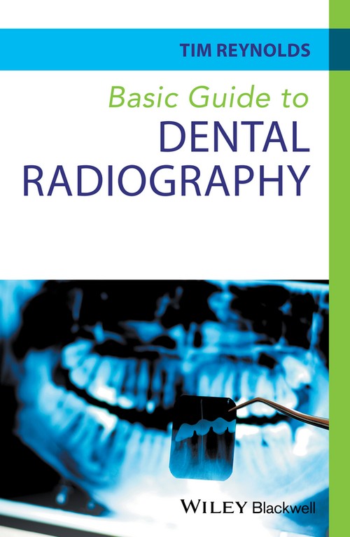 Basic Guide to Dental Radiography by Tim Reynolds ISBN 9780470673126